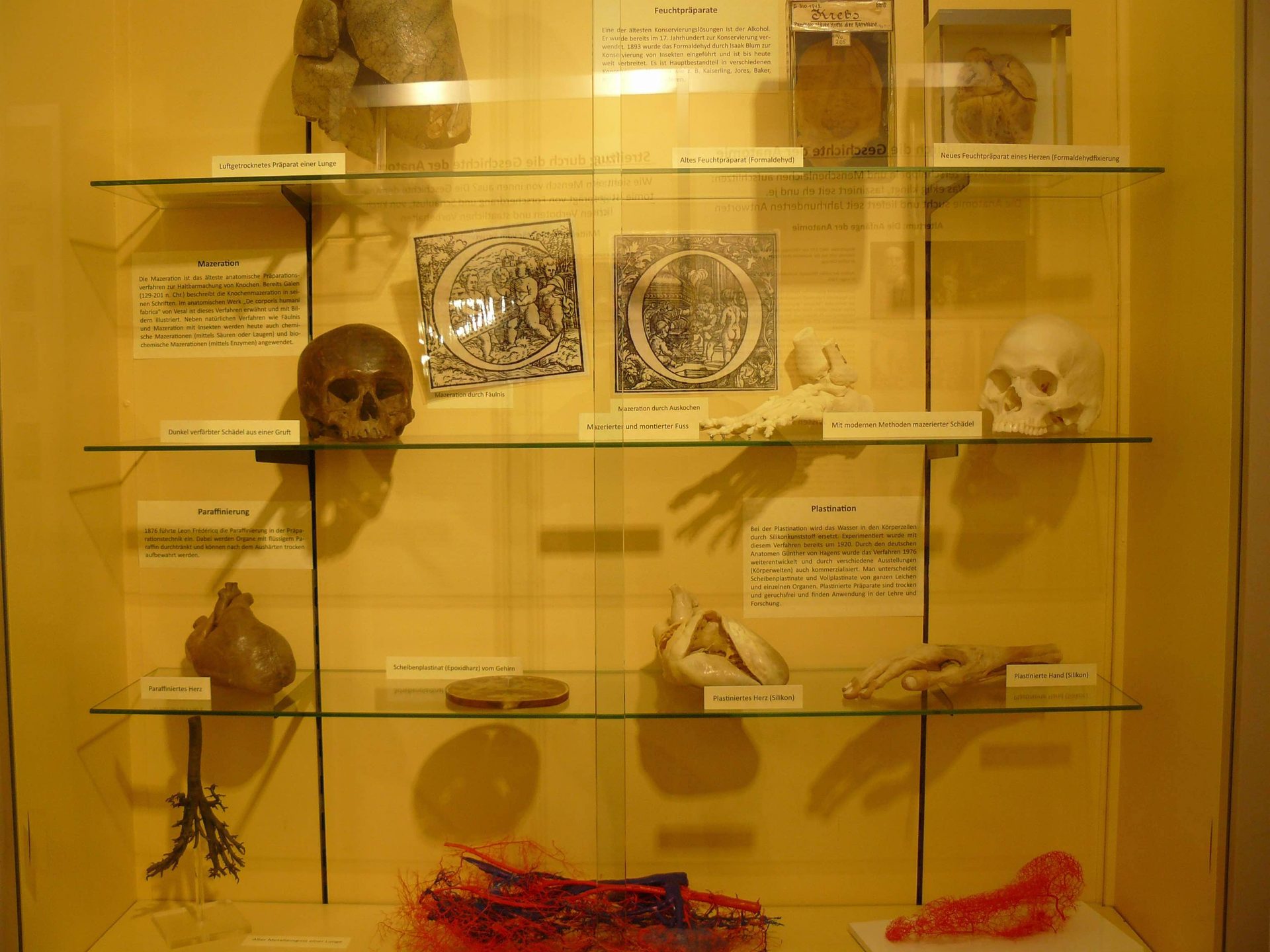 Anatomical models.jpg